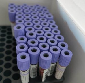Ação- do- Projeto- DOADEZ- reforça- cadastro -de -doadores- de- Medula- Óssea-Medicina_Cesmac (15)