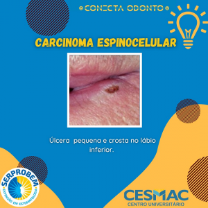 CONECTA- ODONTO- recebe- programação- do- Projeto- SERPROBEM- Cesmac (20)