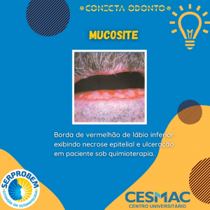 CONECTA- ODONTO- recebe- programação- do- Projeto- SERPROBEM- Cesmac (20)