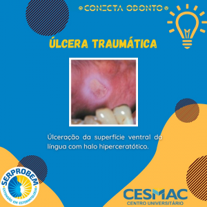 CONECTA- ODONTO- recebe- programação- do- Projeto- SERPROBEM- Cesmac (20)