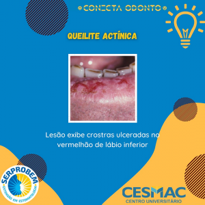 CONECTA- ODONTO- recebe- programação- do- Projeto- SERPROBEM- Cesmac (20)