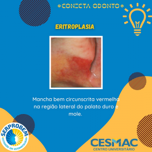 CONECTA- ODONTO- recebe- programação- do- Projeto- SERPROBEM- Cesmac (20)