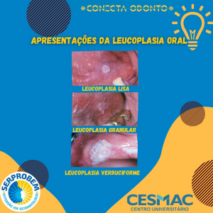 CONECTA- ODONTO- recebe- programação- do- Projeto- SERPROBEM- Cesmac (20)